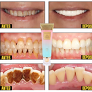 PastaClean - Remova TODAS Imperfeições Bucais | COMPRE 1 LEVE 2 + Frete GRÁTIS