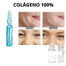 KIT RENEW 3 AMPOLAS | PROMOÇÃO ESPECIAL